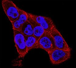 Mouse IL-1ra/IL-1F3 Antibody, R D Systems 25 &mu;g; Unconjugated:Antibodies,