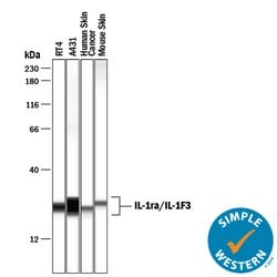 Human IL-1ra/IL-1F3 Antibody, R D Systems 100&mu;g; Unlabeled:Antibodies,
