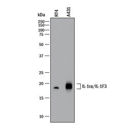 Human IL-1ra/IL-1F3 Antibody, R D Systems 100&mu;g; Unlabeled:Antibodies,