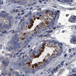 Human IL-2 Antibody, R D Systems:Antibodies:Primary Antibodies