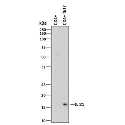 Human IL-21 Antibody, R D Systems 100 &mu;g | Buy Online | R&D Systems | Fisher Scientific