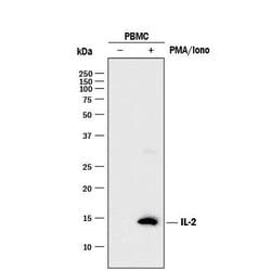 Human IL-2 Antibody, R D Systems 1 mg | Buy Online | R&D Systems | Fisher Scientific