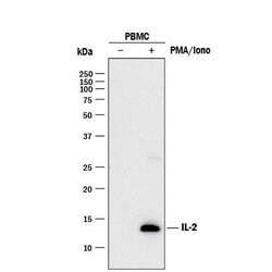 Human IL-2 Antibody, R D Systems 25&mu;g; Unlabeled:Antibodies, Polyclonal