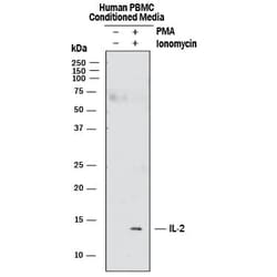 Human IL-2 Antibody, R D Systems:Antikroppar:Primära antikroppar