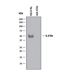 Human IL-6R alpha Antibody, R D Systems:Antibodies:Primary Antibodies