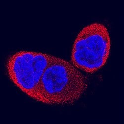 Human IMPA1/IMP1 Antibody, R D Systems:Antibodies:Primary Antibodies