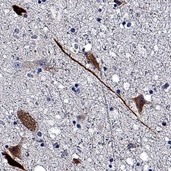Human IMPA1/IMP1 Antibody, R D Systems:Antibodies:Primary Antibodies