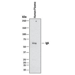 Human IgA Antibody, R D Systems 100&mu;g:Antibodies