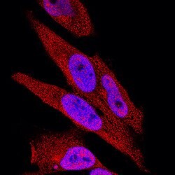Human/Mouse IkB-alpha Antibody, R D Systems 100 &mu;g | Buy Online | R&D Systems | Fisher Scientific