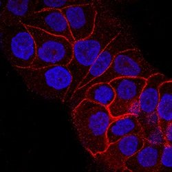 Human Insulin R/CD220 Antibody, R D Systems 100&mu;g:Antibodies, Monoclonal