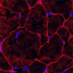 Human Irisin/FNDC5 Antibody, R D Systems:Antibodies:Primary Antibodies