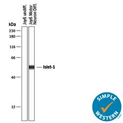 Human Islet-1 Antibody, R D Systems 25&mu;g; Unlabeled:Antibodies, Polyclonal