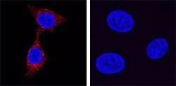 Human Kallikrein 3/PSA Antibody, R D Systems 100&mu;g; Unlabeled:Antibodies,