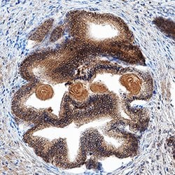 Human Kallikrein 3/PSA Antibody, R D Systems 500 &mu;g | Buy Online | R&D Systems | Fisher Scientific