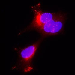 Human Kallikrein 3/PSA Antibody, R D Systems:Antibodies:Primary Antibodies