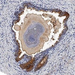 Human Kallikrein 3/PSA Antibody, R D Systems:Antibodies:Primary Antibodies
