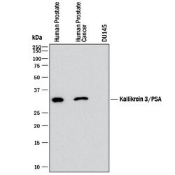 Human Kallikrein 3/PSA Antibody, R D Systems:Antibodies:Primary Antibodies