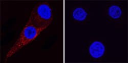Human Kallikrein 3/PSA Antibody, R D Systems:Antibodies:Primary Antibodies