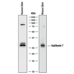 Kallikrein 7 Goat anti-Human, Polyclonal, R D Systems 25&mu;g; Unlabeled,