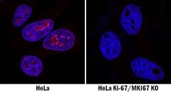 Human Ki67/MKI67 Antibody, R D Systems 100&mu;g; Unlabeled:Antibodies,