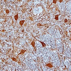 Human Kininogen Antibody, R D Systems 25&mu;g; Unlabeled:Antibodies, Monoclonal