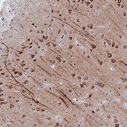 Human LC3A Antibody, R D Systems 25&mu;g:Antibodies, Monoclonal