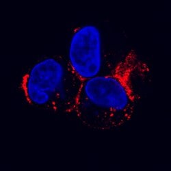 Human LDLR Antibody, R D Systems 25&mu;g; Unlabeled:Antibodies, Polyclonal