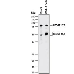 Human LEDGF Antibody, R D Systems 25&mu;g; Unlabeled:Antibodies, Polyclonal