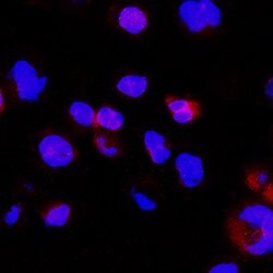 LIGHT/TNFSF14 Rabbit anti-Human, Clone: 2323A, R D Systems 100&mu;g:Antibodies,