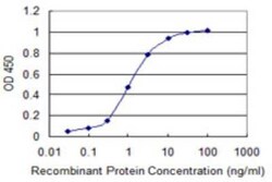LMTK3 Antibody (5A10), Novus Biologicals 0.05 mg | Buy Online | Novus Biologicals | Fisher Scientific