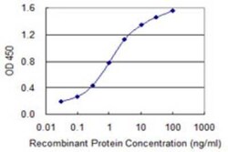 LMTK3 Antibody (6C5), Novus Biologicals 0.1 mg; Unconjugated:Antibodies,