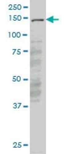 LMTK3 Antibody (6C5), Novus Biologicals 0.1 mg; Unconjugated:Antibodies,