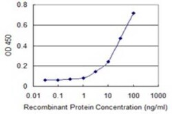 LRRC2 Antibody (1G3), Novus Biologicals 0.1 mg | Buy Online | Novus Biologicals | Fisher Scientific