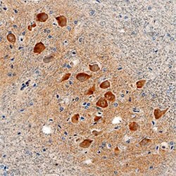 Human LRRC3 Antibody, R D Systems:Antibodies:Primary Antibodies