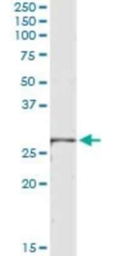LRRK1 Antibody (3G8), Novus Biologicals 0.1 mg | Buy Online | Novus Biologicals | Fisher Scientific