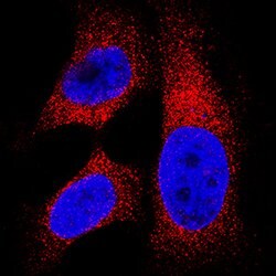 Human Lactate Dehydrogenase B/LDHB Antibody, R D Systems:Antibodies:Primary