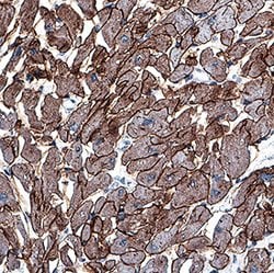 Human Laminin alpha 2 Antibody, R D Systems 100 &mu;g; Unconjugated:Antibodies,
