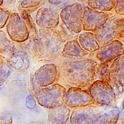 Human Lck Antibody, R D Systems 100&mu;g; Unlabeled:Antibodies, Polyclonal