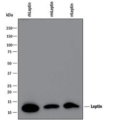 Human Leptin/OB Antibody, R D Systems 100&mu;g; Unlabeled:Antibodies, Polyclonal