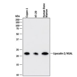 Human Lipocalin-2/NGAL Antibody, R D Systems 500&mu;g; Unlabeled:Antibodies,