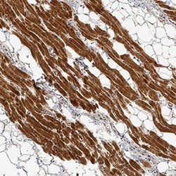 Human/Mouse Lipoprotein Lipase/LPL Antibody, R D Systems 100&mu;g; Unlabeled:Antibodies,