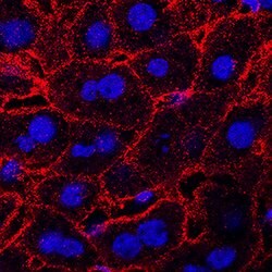 Mouse Lymphotoxin beta R/TNFRSF3 Antibody, R D Systems:Antibodies:Primary