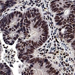 Human EGR1 Antibody, R D Systems EGR1 Antibody; Unconjugated; 25 &mu;g:Antibodies,