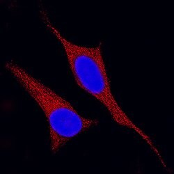 Human/Mouse/Rat MEK2 Antibody, R D Systems 100ug; Unlabeled:Antibodies,