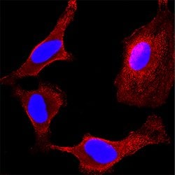 Human MKK4 Antibody, R D Systems 25&mu;g; Unlabeled:Antibodies, Monoclonal