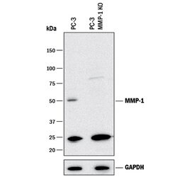 Human MMP-1 Antibody, R D Systems 25&mu;g; Unlabeled:Antibodies, Polyclonal