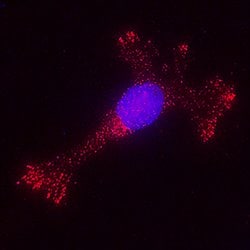 Human/Primate MMP-9 Antibody, R D Systems:Antibodies:Primary Antibodies