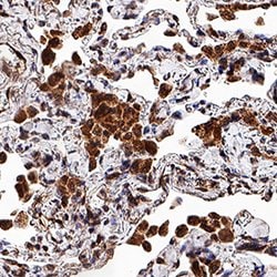 Human/Primate MMP-9 Antibody, R D Systems:Antibodies:Primary Antibodies