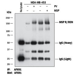 Human MSPR/Ron Antibody, R D Systems 25&mu;g; Unlabeled:Antibodies, Polyclonal