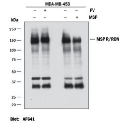 Human MSPR/Ron Antibody, R D Systems 25&mu;g; Unlabeled:Antibodies, Polyclonal